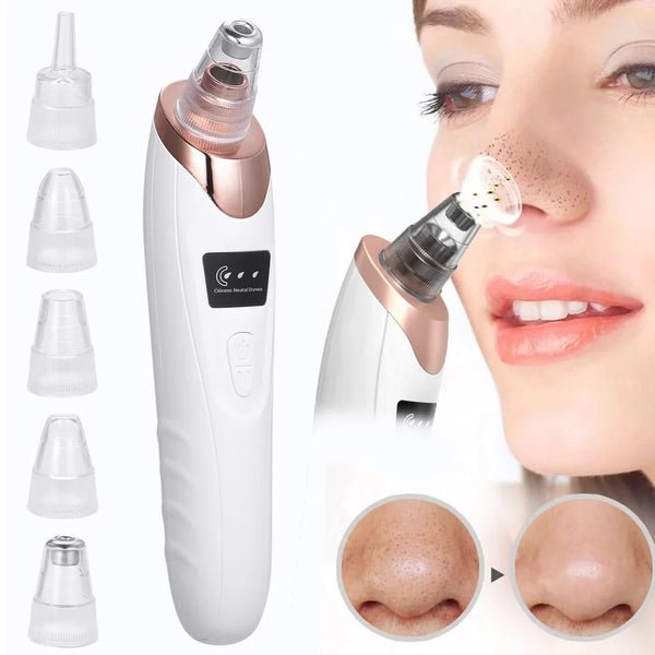 Electric Blackhead Suction Tool – Clear & Smooth Skin