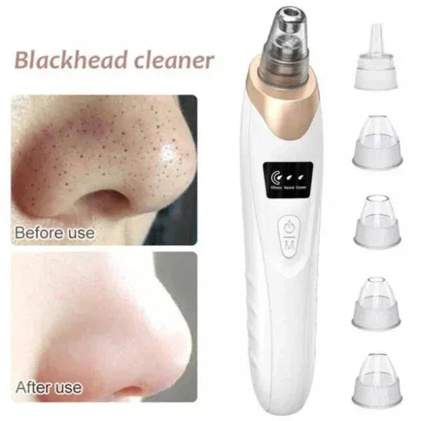 Electric Blackhead Suction Tool – Clear & Smooth Skin