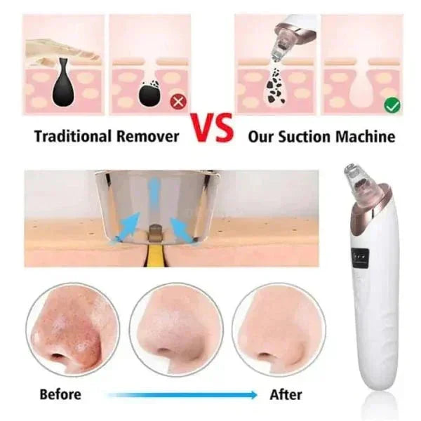 Electric Blackhead Suction Tool – Clear & Smooth Skin