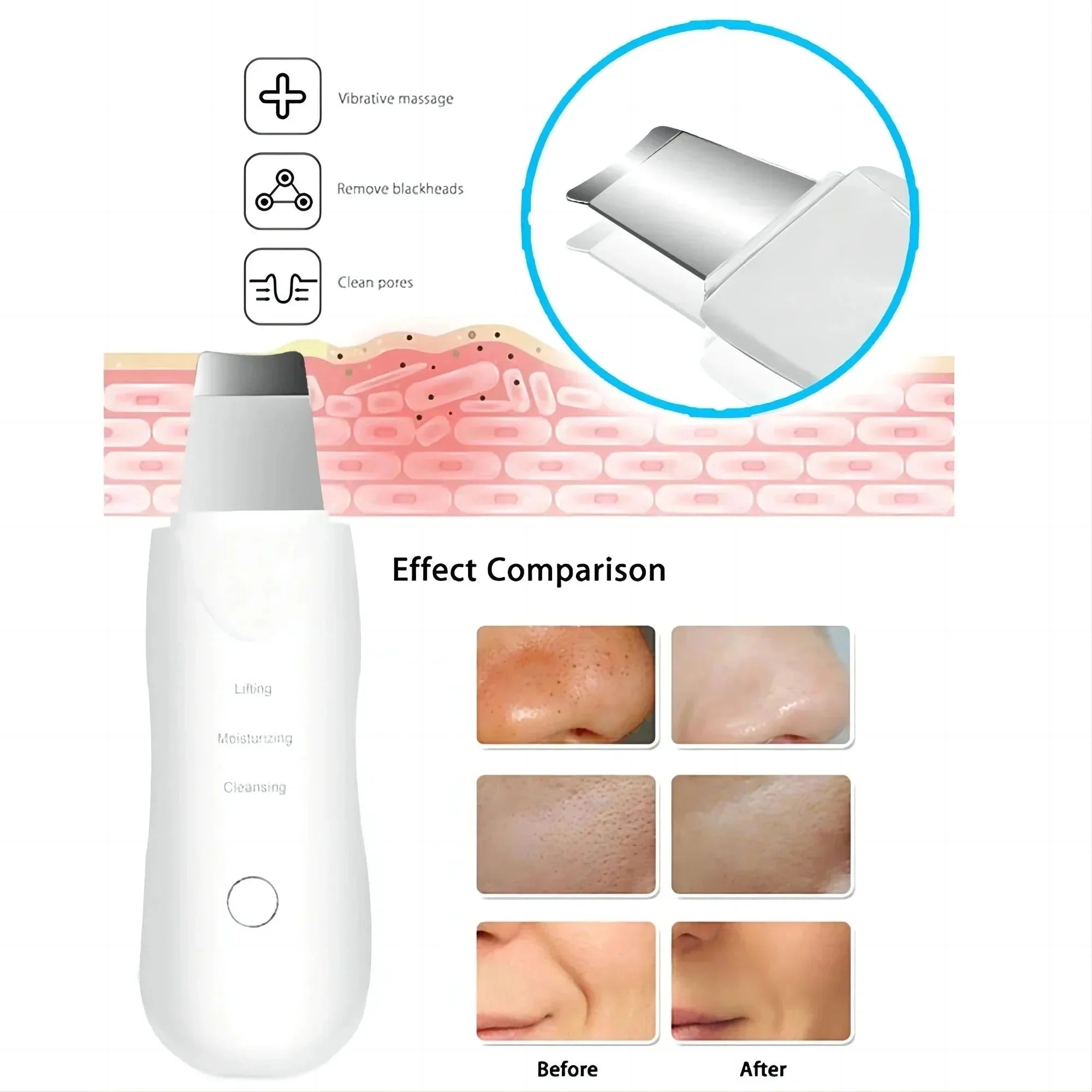 Ultrasonic Skin Scrubber – Rechargeable & Deep Cleaning
