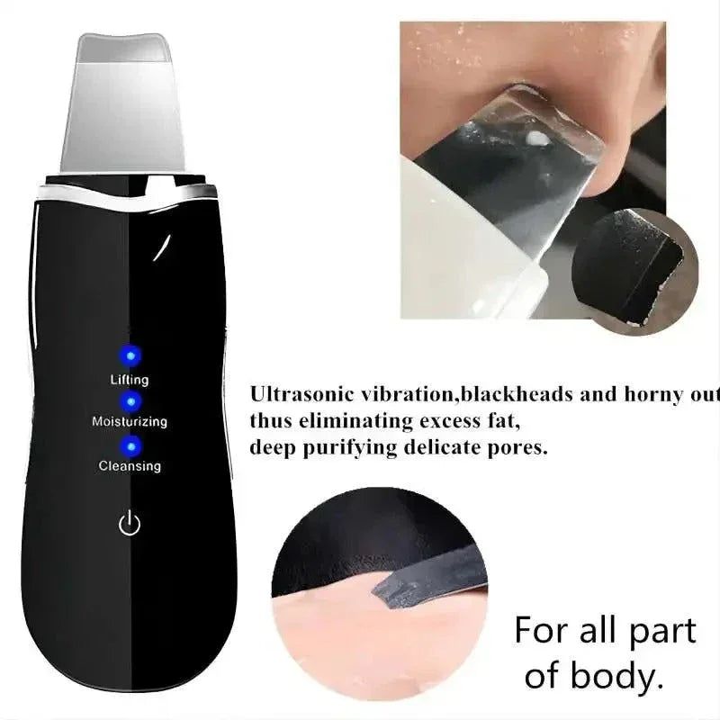 Ultrasonic Skin Scrubber – Rechargeable & Deep Cleaning